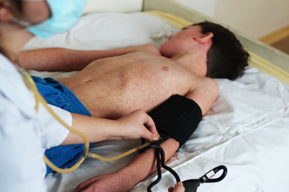Atención médica del sarampión